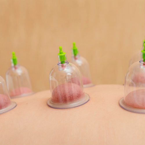 HIJAMA