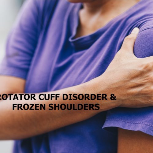 ROTATOR CUFF FROZEN S